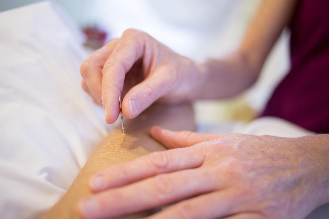 Acupuncture and Pain Management | Joyful TCM Bella Vista NSW